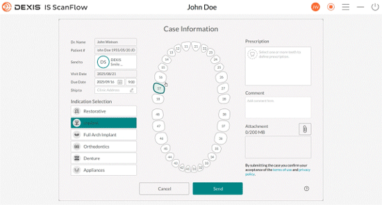 Animation of DEXIS IS ScanFlow: Give your labs what they need