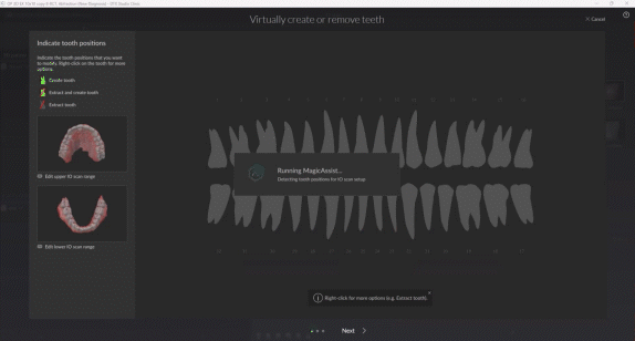 Animation of using DTX Studio Clinic: Set up your full case in seconds