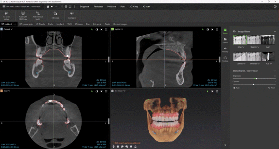 Animation showing DTX Studio-Clinin: Plan your treatmet in minutes