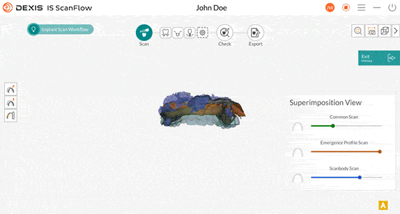 DEXIS IS ScanFlow with AI assisted accuracy