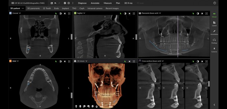 Maxillofacial surgery