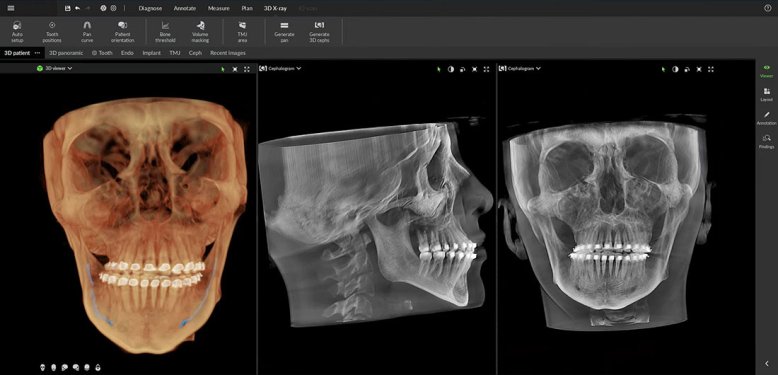 Ortho