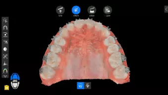 Clinical case: DEXIS IS 3600 (ortho)