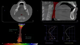 Case study: Bridging the Gap with 3D Imaging