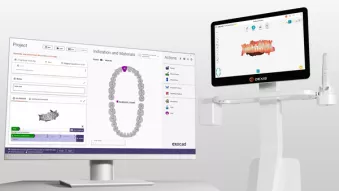 DEXIS IS ScanFlow integration with exocad