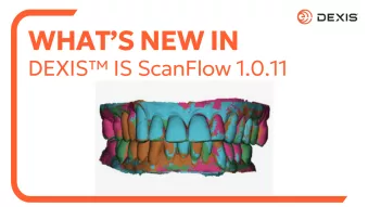 What's New In DEXIS IS ScanFlow 1.0.11 video thumbnail