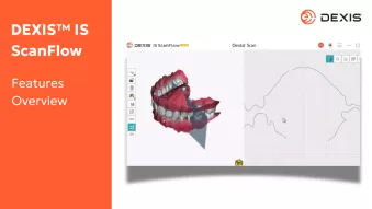 DEXIS IS ScanFlow Features Overview video thumbnail