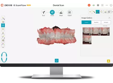DEXIS IS ScanFlow: Check with intraoral pictures