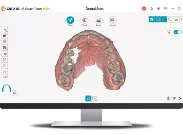 DEXIS IS ScanFlow: with real time feedback of missing data