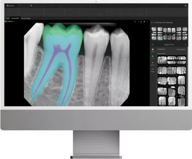 DTX Studio Clinic: 2D image