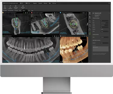 DTX Studio: monitor with implant case