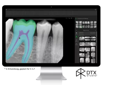 Bildschirm mit DTX Studio Clinic 2D-Funktion Anatomische Strukturen