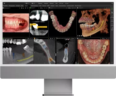 DTX Studio Clinic: Bring your images home