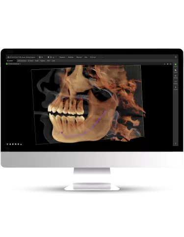 OP 3D EX image