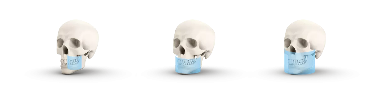 Дооснащение модулем 3D
