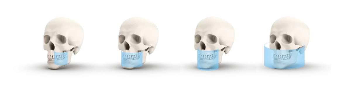 Дооснащение модулем 3D