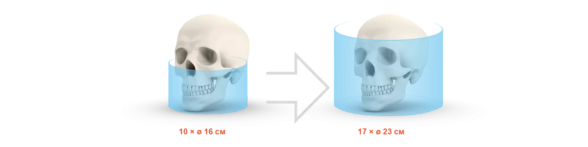 OP 3D Vision апгрейд