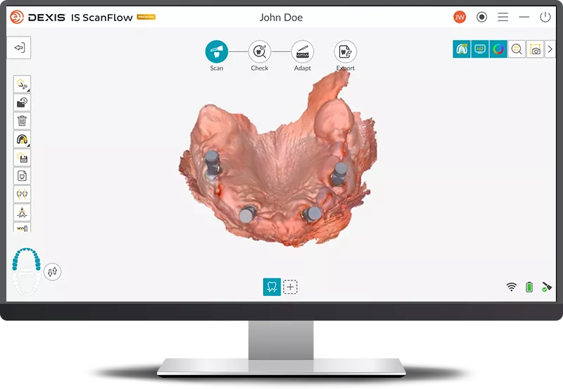 DEXIS IS ScanFlow: AI Matching