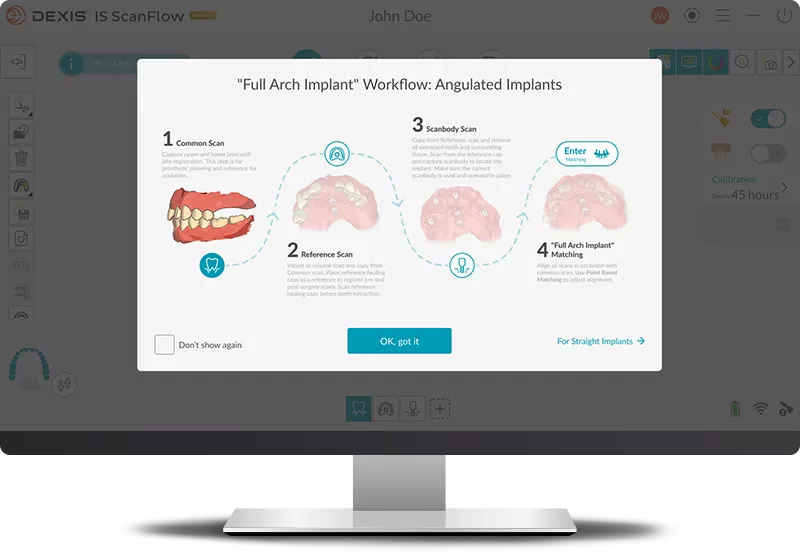 DEXIS IS ScanFlow: Acquire accurate full-arch data the new "Full Arch Implant" workflow