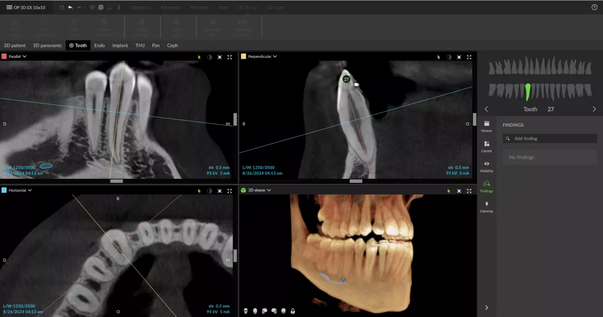 Auto 3D tooth postioning