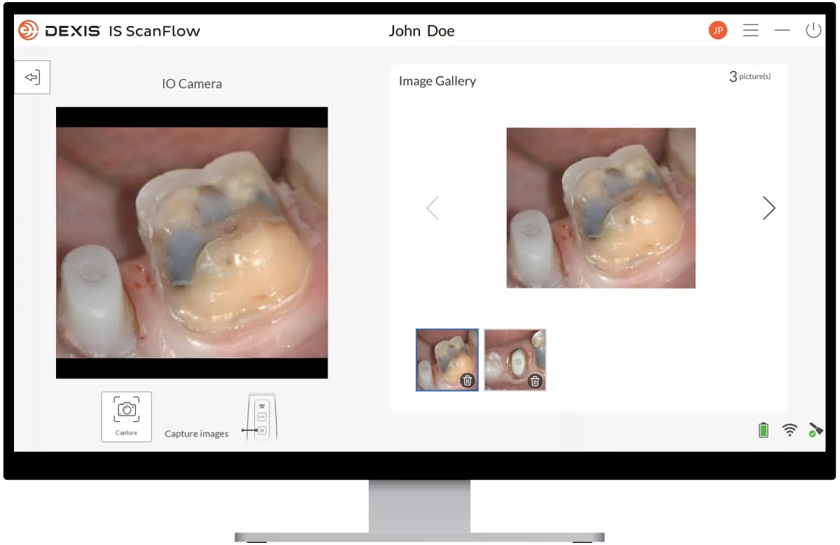 DEXIS IS ScanFlow 1.0.9.2: 2D Capture and edit