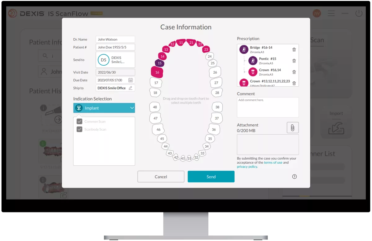 DEXIS IS ScanFlow: CaseFlow Manage