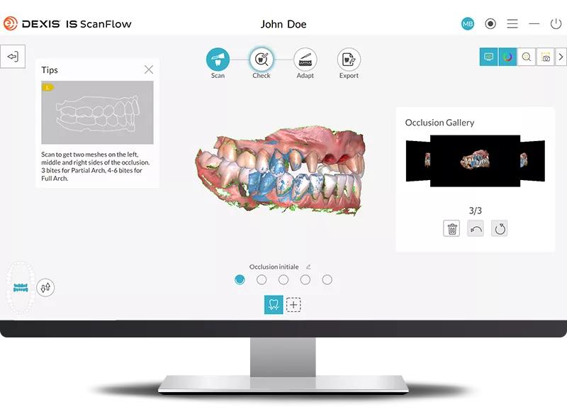 DEXIS IS ScanFlow: Clear, accurate data