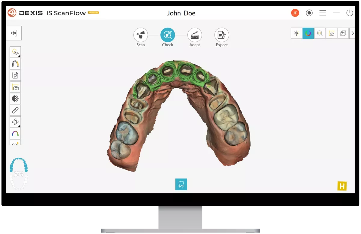 DEXIS IS ScanFlow 1.0.9.2: Hybrid scanning