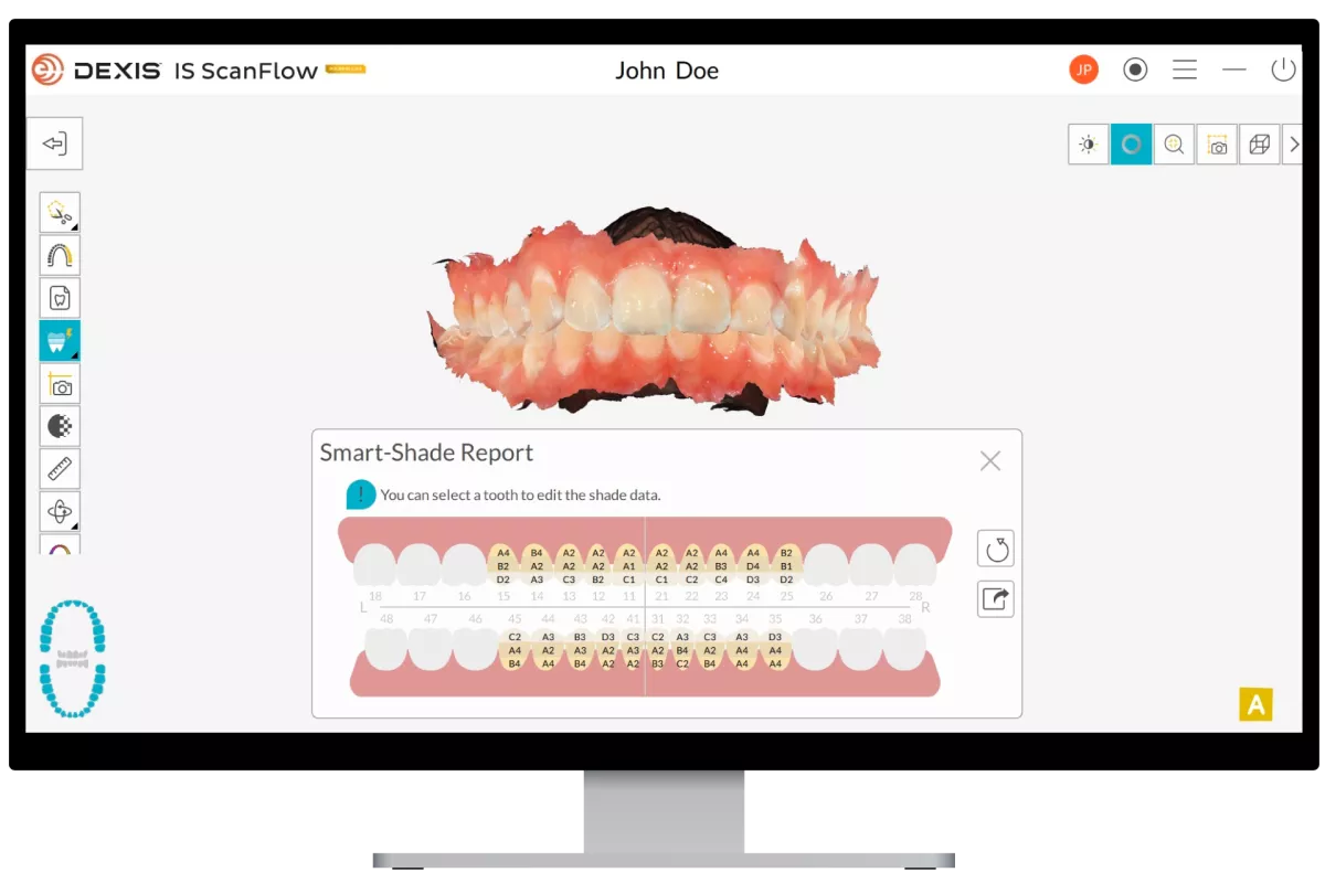 DEXIS IS ScanFlow: Smart & Shade