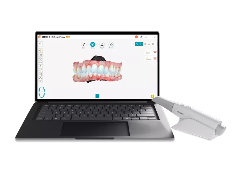 DEXIS IS ScanFlow with DEXIS Imprevo 