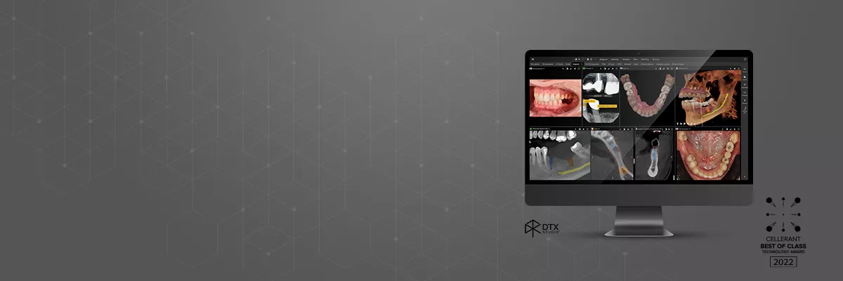 DTX 3.2 with 2D Dental Findings*