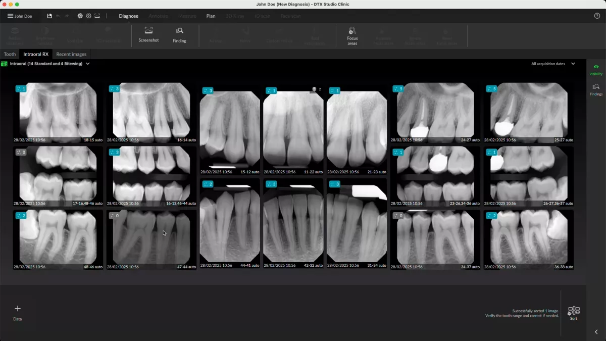 DTX Studio Clinic 2D - import all your images