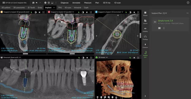 DTX Studio Clinic 3D