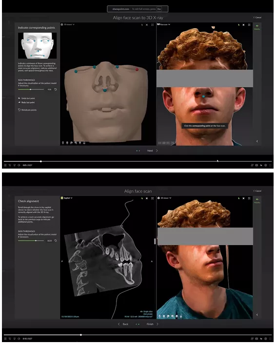 DTX Studio Clinic Align face scans with CBCT