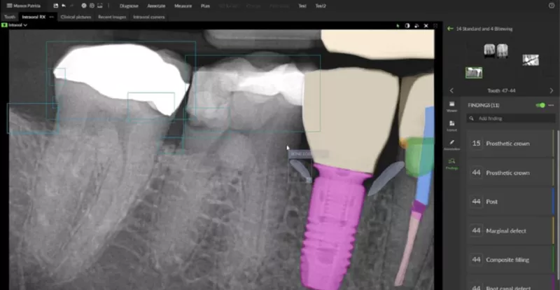 DTX Studio Clinic: Detect past treatments