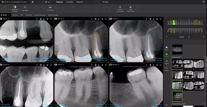 DTX Studio Clinic Navigate by tooth