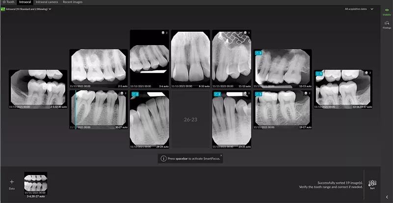 DTX Studio Clinic Use AI to instantly recognize, orient, and mount teeth on a templat.png