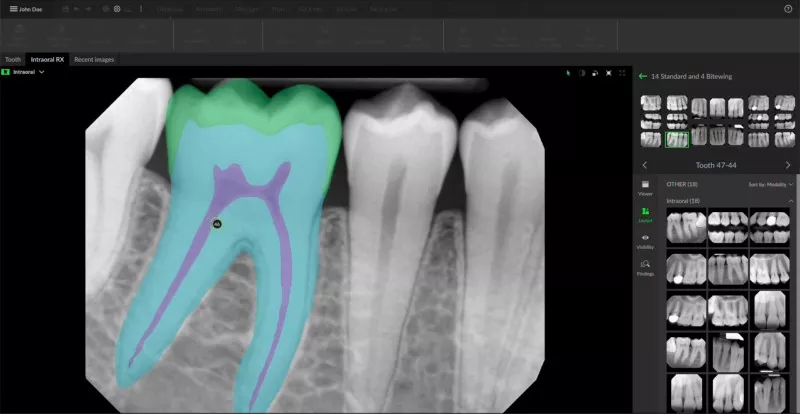 DTX Studio Clinic: Visualize anatomical structures