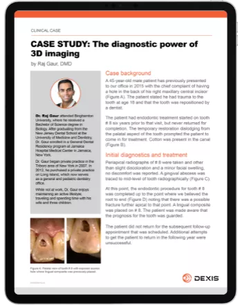 CASE STUDY by Dr Raj Gaur: The diagnostic power of 3D imaging.png
