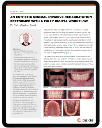 An Esthetic Minimal Invasive Rehabilitation Performed with a Fully Digital Workflow Clinical case by Dr. Carlo Massimo Saratti (cover)