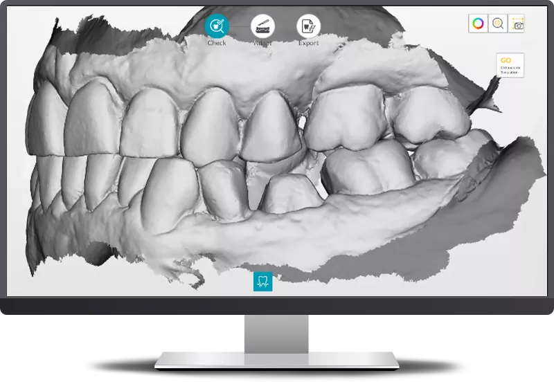 DEXIS IS ScanFlow: Systematically detect problem areas in your scan