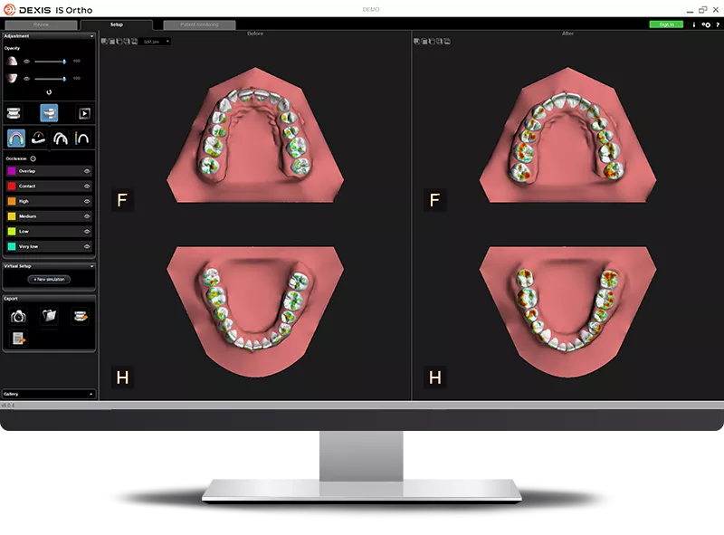 IS Ortho: Sell occlusion map dual views