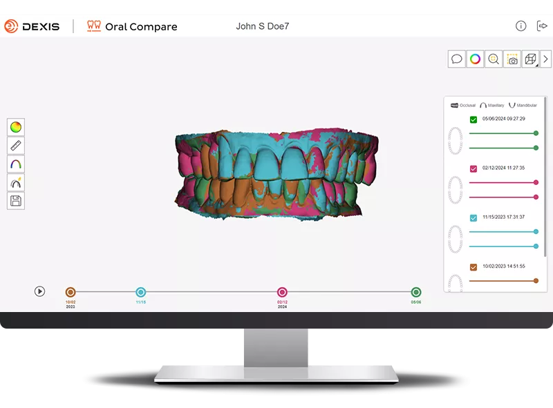 DEXIS IS ScanFlow showing Oral Compare