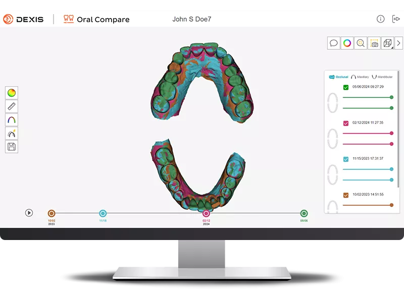 DEXIS IS ScanFlow showing Oral Compare