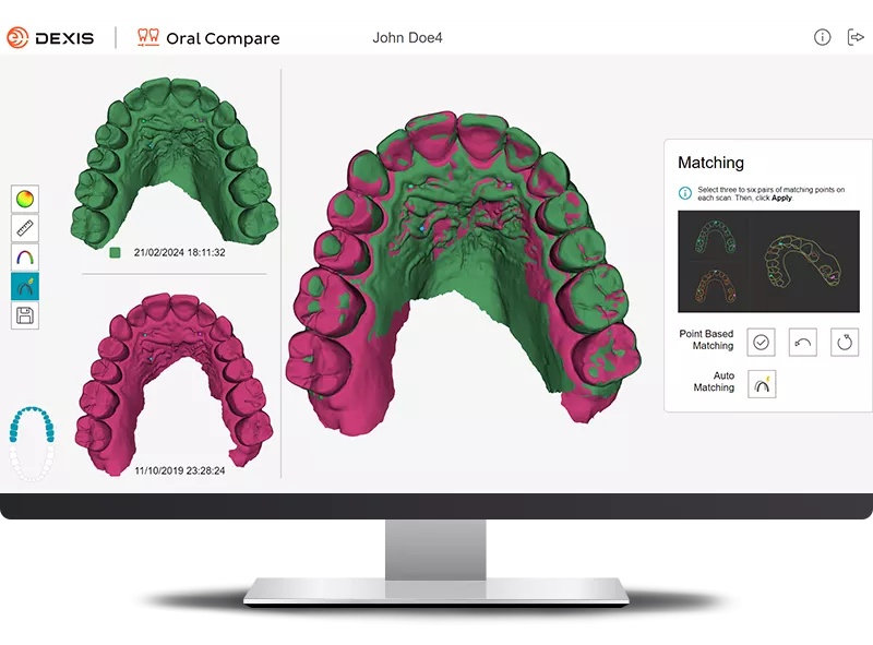 DEXIS IS ScanFlow showing Oral Compare