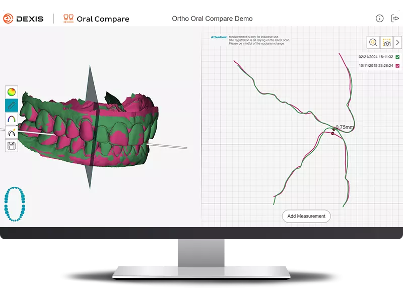 DEXIS IS ScanFlow showing Oral Compare