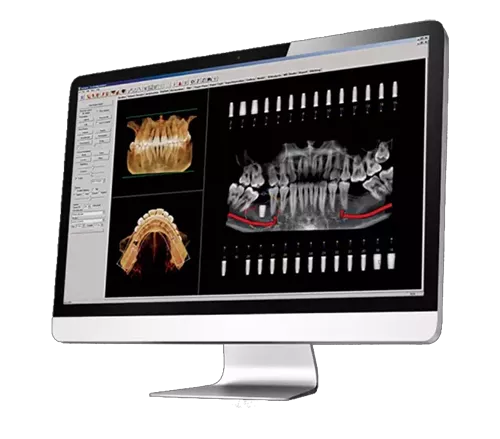 Invivo 6.1 on monitor