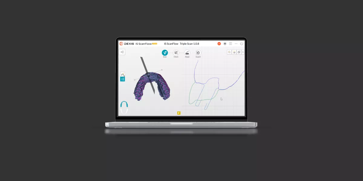 DEXIS IS ScanFlow 1.0.8 Release