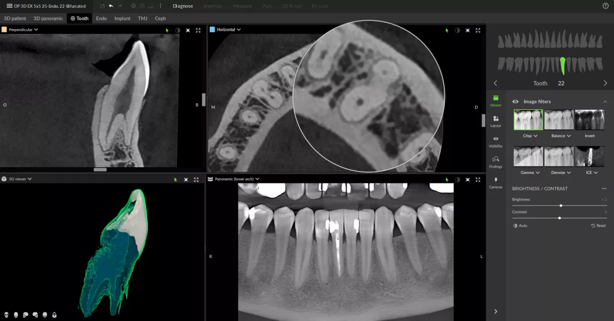 cbct data DTX