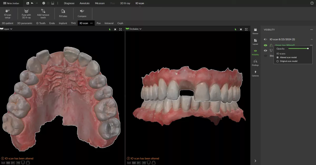 Uses AI to extract or create virtual teeth DTX